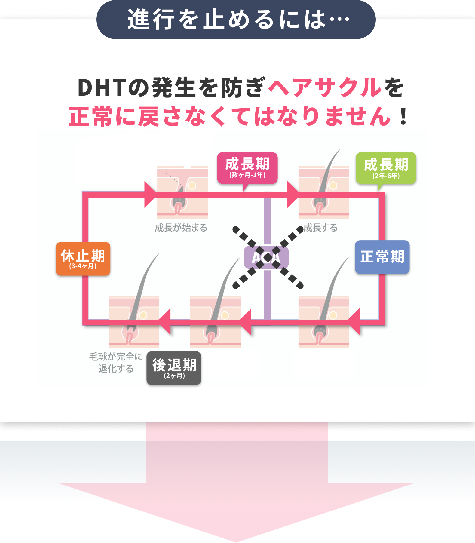 AGAの進行を止めるにはDHTの発生を防ぎヘアサクルを正常に戻さなくてはなりません！