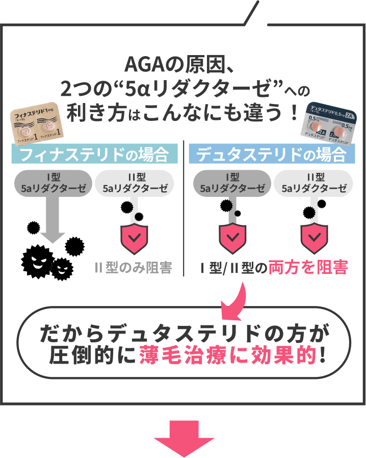 ＡＧＡの原因、2つの5αリダクターゼへの効き方はこんなにも違う！